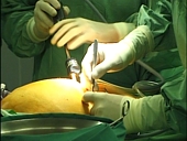 Chirurgie